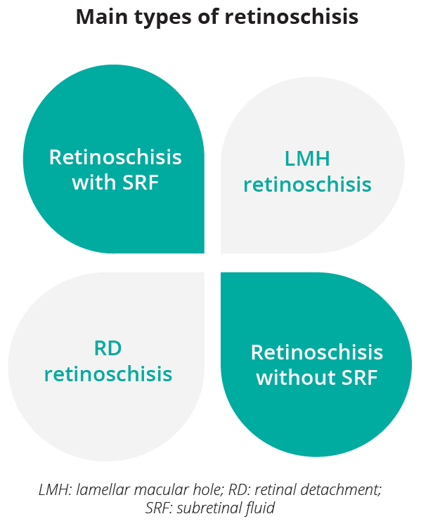 What are the main types of retinoschisis?