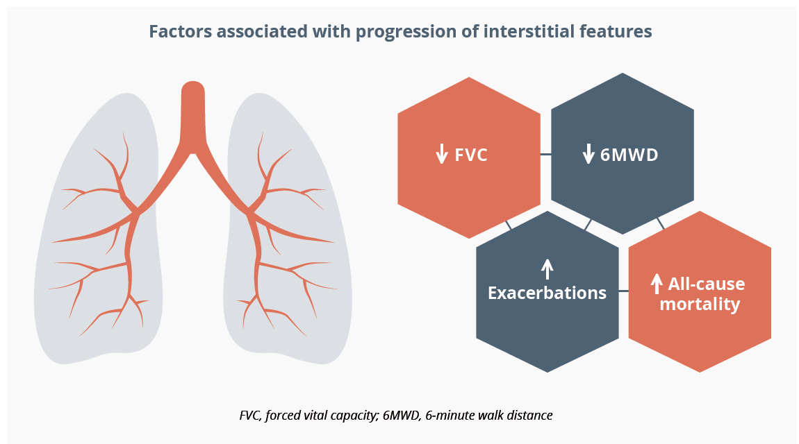 FVC, 6MWD, exacerbations and all-cause mortality have been associated with progression of interstitial features
