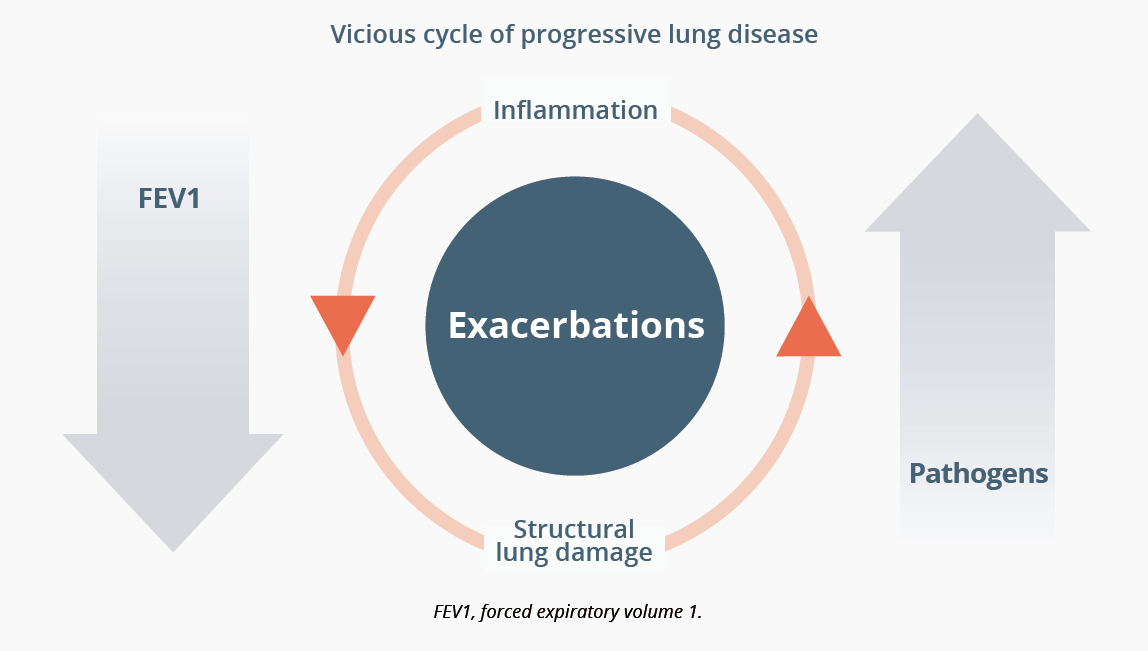 Vicious cycle of progressive lung disease from inflammation to structural lung damage.