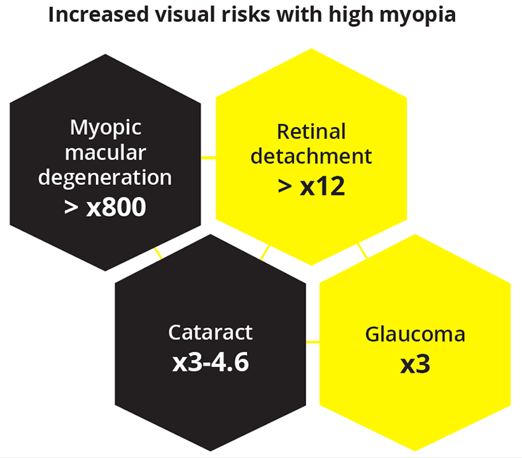 High myopia levels are associated with increased risk of macular degeneration, retinal detachment, cataracts and glaucoma
