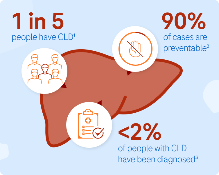 Diagram with statistics of chronic liver disease prevalence.
Demonstrates 1 in 5 people have CLD, but less than 2 percent of these have
been diagnosed and 90 percent of cases are preventable.